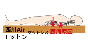 西川エアー、モットンマットレス腰痛理由と治し方北海道、札幌，