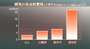 睡眠とアルツハイマー病の関係