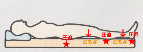 寝て脚の疲れが取れない状態,下半身の圧迫と脚の支え無しがだるさになる