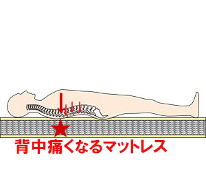 背中が痛くなるマットレス, 背中が痛くなるマットレス,