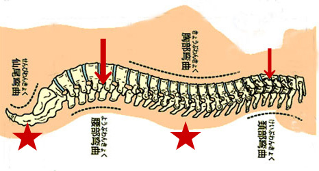 寝返りしたくなる背中が痛くなる理由