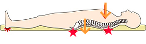 煎餅布団と低反発マットレスで背中が痛くなる理由