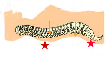 仰向けに寝て背中が痛くなる理由,背中の凹凸,