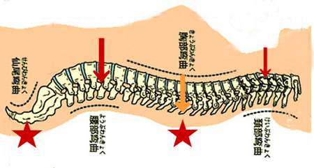 寝返りと腰痛の関係,