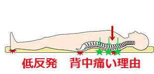 低反発トゥルースリーパー背中痛い理由，