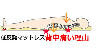 トゥルースリーパー背中、体痛い理由と治し方，