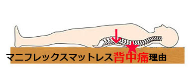 マニフレックスマットレス背中痛い，