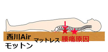 西川エアー、モットンマットレス腰痛理由と治し方北海道、札幌,