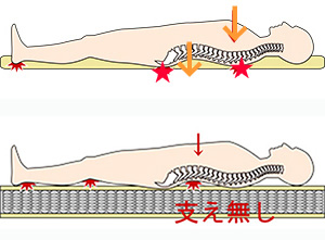 寝ると腰や背中が痛くなる,寝心地良くない体に合っていないマットレス,
