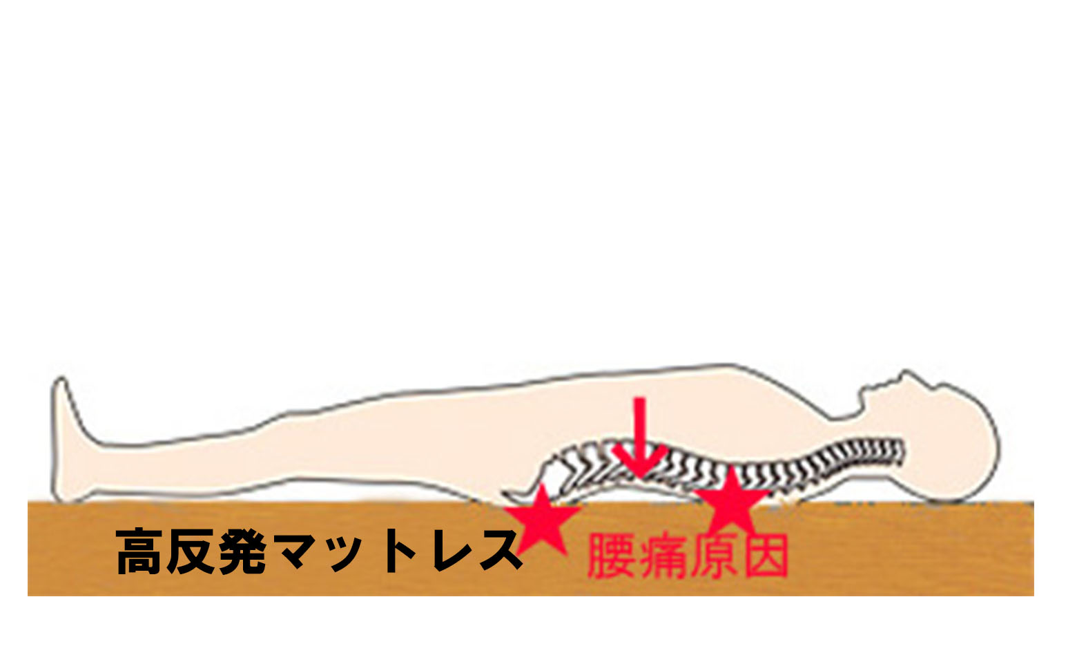 マニフレックス、モットン腰痛理由，