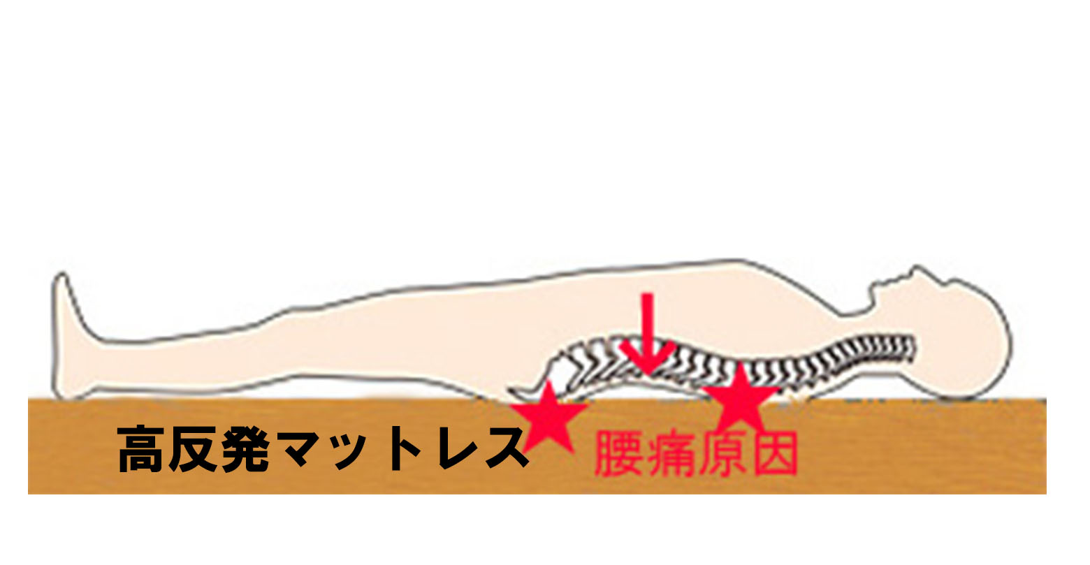 マニフレックスマットレス腰痛原因, マニフレックスマットレス腰痛原因,