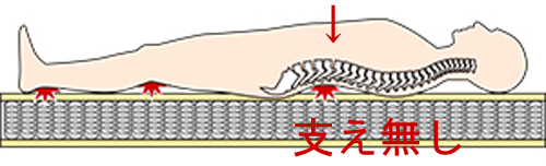 腰痛発生原因