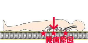 コイルスプリングマットレス腰痛原因，