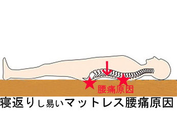 西川エアー、ムアツふとん腰痛原因，