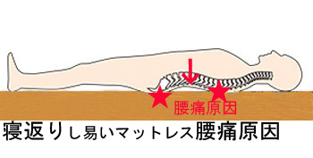 寝返りし易いマットレス腰痛原因, 寝返りし易いマットレス腰痛原因,