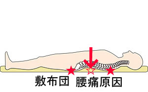 うつぶせ寝原因せんべい布団，