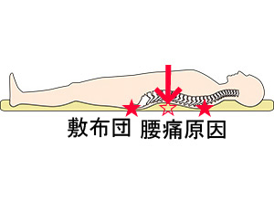 床に敷布団、スノコに敷布団で腰痛原因，