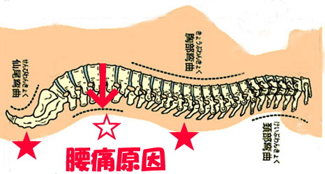 寝たら治る腰痛,