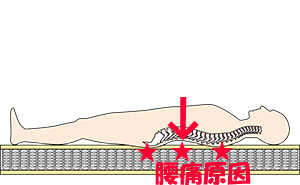 腰良いンベッド、腰痛原因ベッド