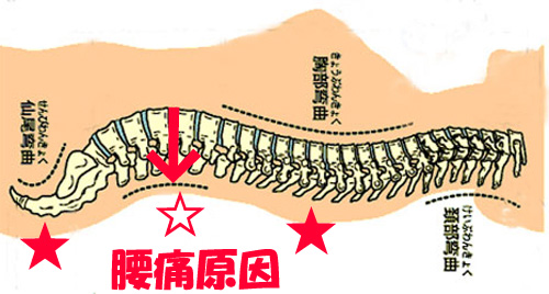 寝ている時の腰痛原因は腰部の凹凸