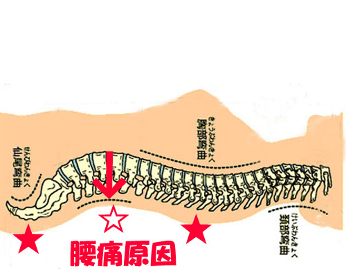 寝て腰が痛くなる理由