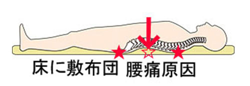 硬い床に敷布団で寝るデメリット腰痛、