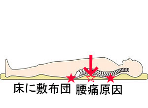 敷布団で腰痛、体の痛み、肩の痛み理由と治し方北海道、札幌，
