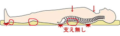 腰痛改善に良いベッドとマットレス,