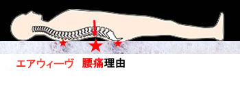 エアウィーヴ腰痛理由,
