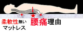 エアウィーヴで寝て腰痛悪化理由，